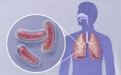 Бактерии туберкулеза. Фото с сайта webmd.com Бактерии туберкулеза. Фото с сайта webmd.com