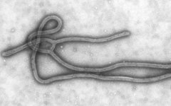  Изображение вируса Эбола, полученное с помощью просвечивающей электронной микро