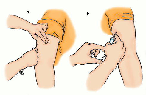 Как сделать укол в руку в мышцу